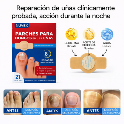 Parches Eilirah para la renovación de uñas contra hongos